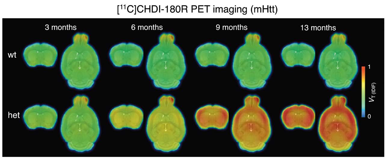 Latest article from our founder on mutant HTT imaging